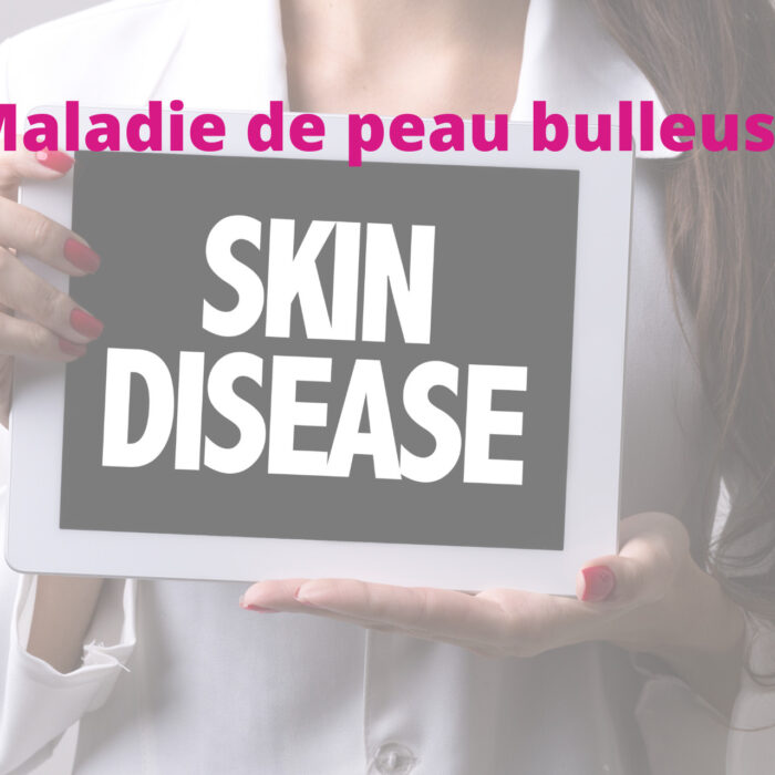 Que faire face à une maladie de peau bulleuse : l’EB héréditaire