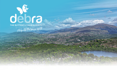 Prévoyez vos vacances grâce au partenariat avec Debra UK