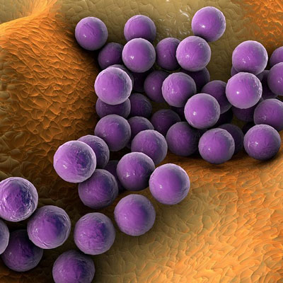 Plaies infectées : les signes qui doivent alerter